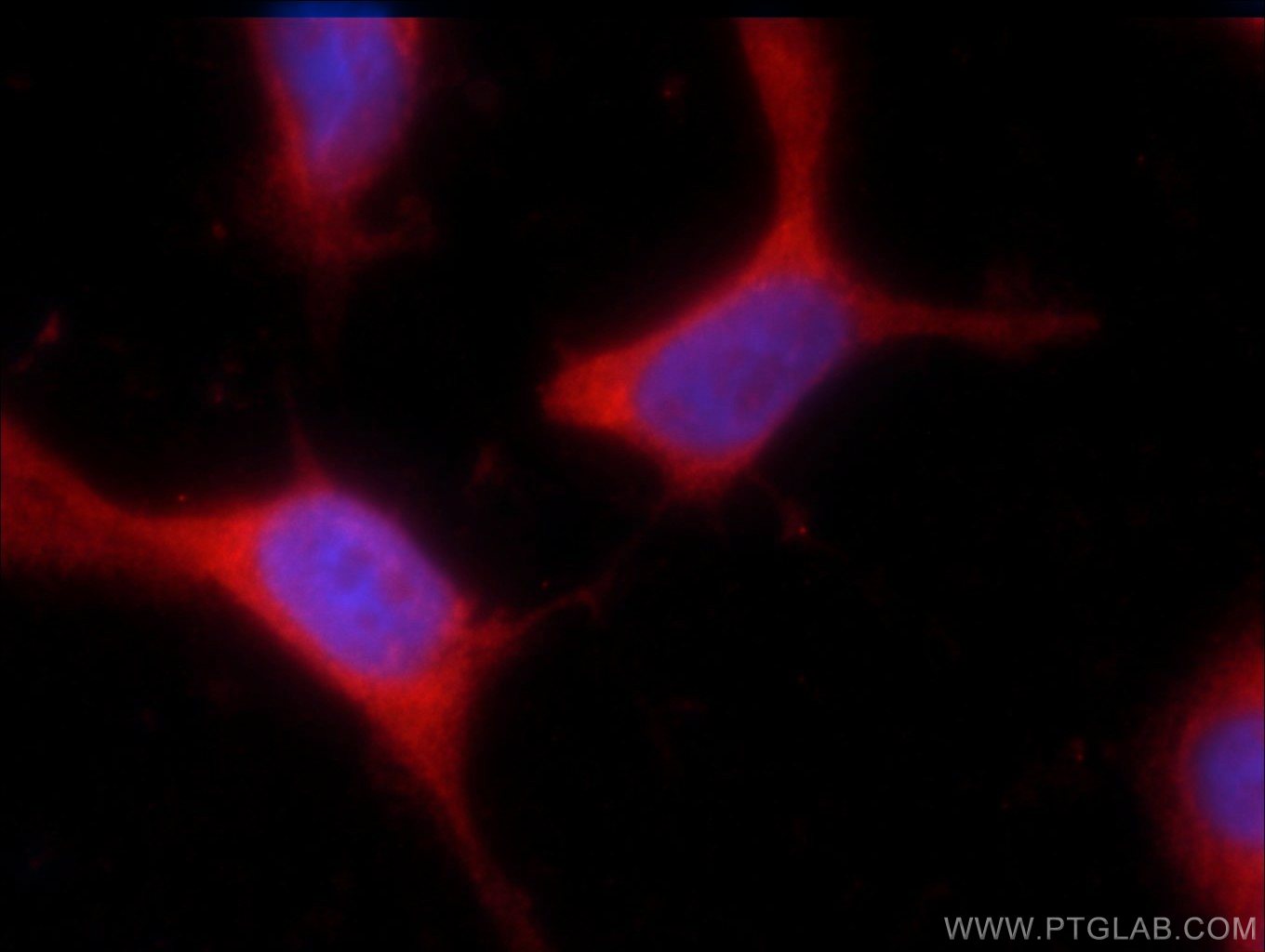 Immunofluorescence (IF) / fluorescent staining of HEK-293 cells using SPANXA2/SPANXA1 Polyclonal antibody (19527-1-AP)