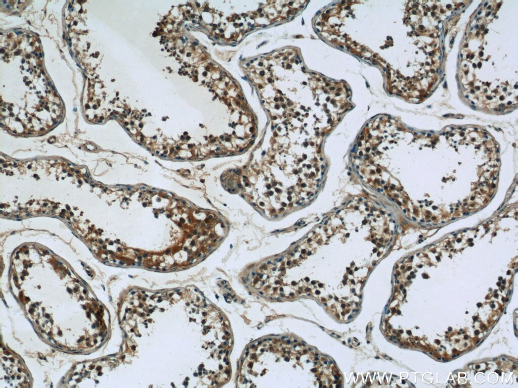 Immunohistochemistry (IHC) staining of human testis tissue using SPANXA2/SPANXA1 Polyclonal antibody (19527-1-AP)