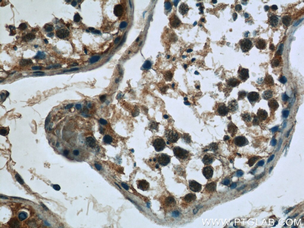 IHC staining of human testis using 19527-1-AP