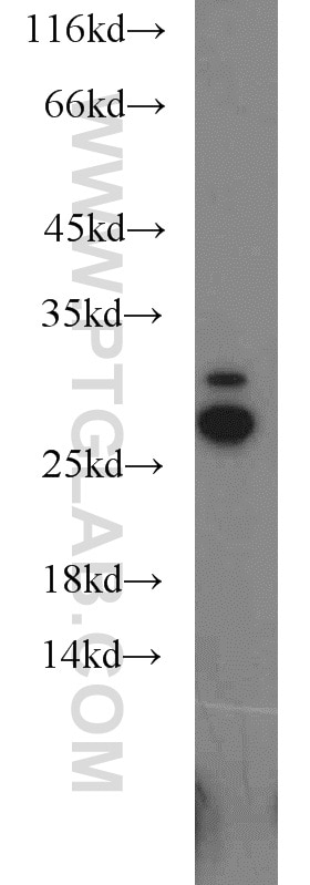 Western Blot (WB) analysis of HEK-293 cells using SPANXA2/SPANXA1 Polyclonal antibody (19527-1-AP)