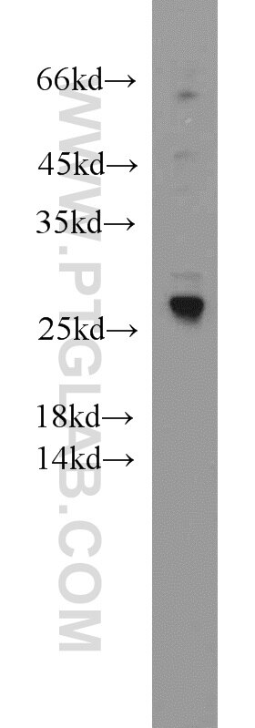 Western Blot (WB) analysis of PC-3 cells using SPANXA2/SPANXA1 Polyclonal antibody (19527-1-AP)