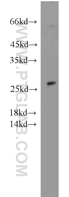 Western Blot (WB) analysis of DU 145 cells using SPANXA2/SPANXA1 Polyclonal antibody (19527-1-AP)