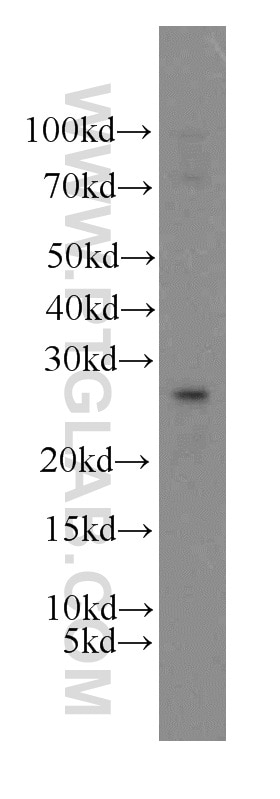 Western Blot (WB) analysis of PC-3 cells using SPANXA2/SPANXA1 Polyclonal antibody (19527-1-AP)