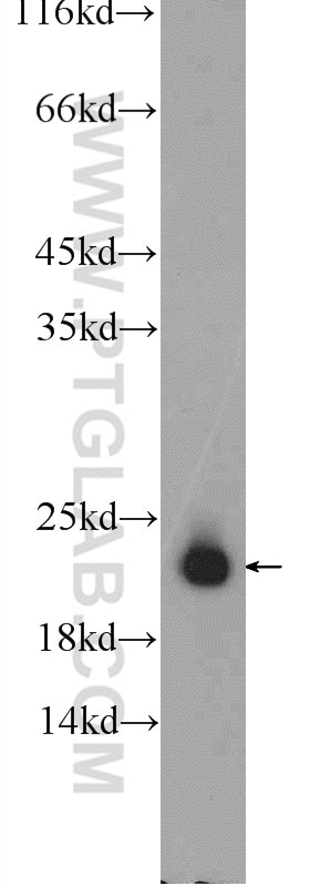 Western Blot (WB) analysis of human testis tissue using SPANXB1 Polyclonal antibody (17072-1-AP)