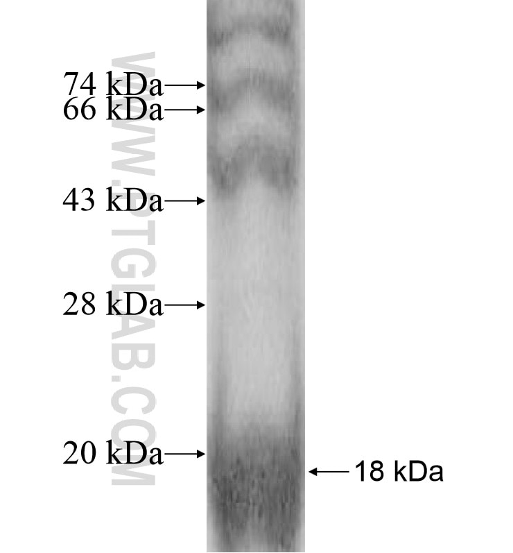 SPANXB1 fusion protein Ag10636 SDS-PAGE