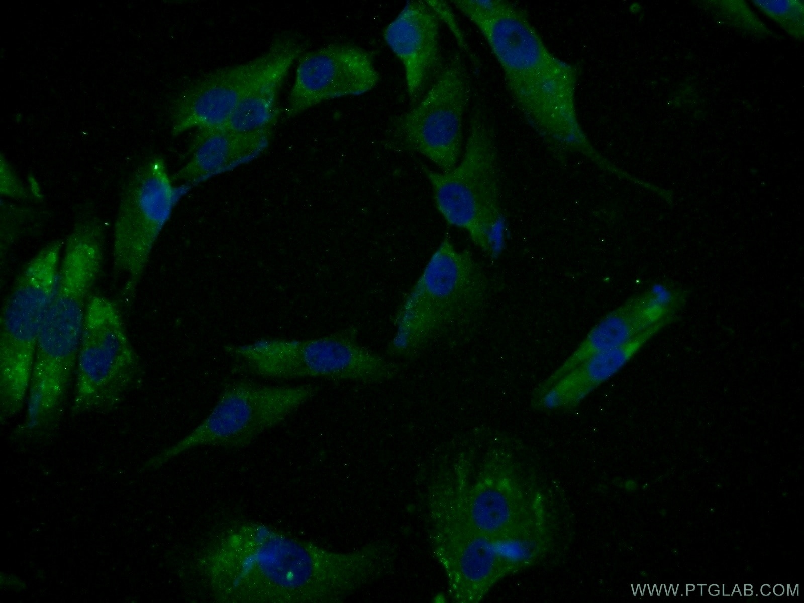 Immunofluorescence (IF) / fluorescent staining of A375 cells using SPANXE Polyclonal antibody (15870-1-AP)
