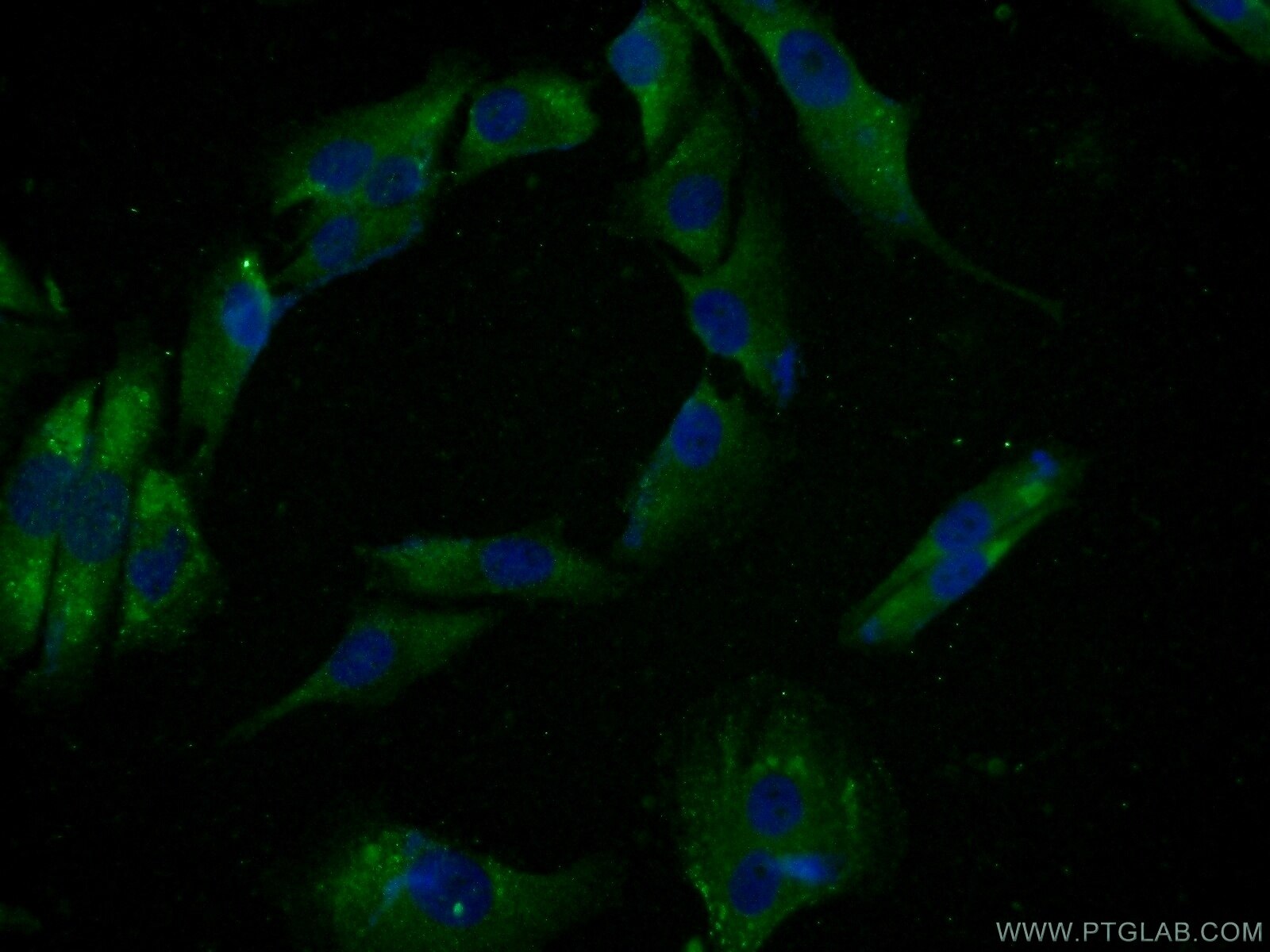 IF Staining of A375 using 15870-1-AP