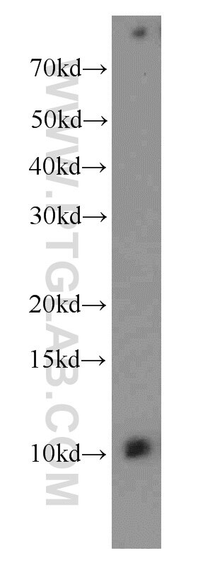 Western Blot (WB) analysis of mouse skin tissue using SPANXE Polyclonal antibody (15870-1-AP)