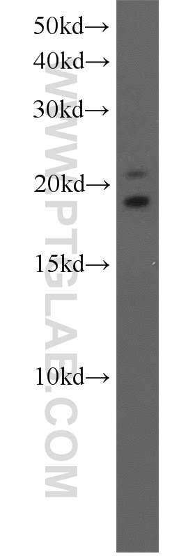 Western Blot (WB) analysis of A375 cells using SPANXE Polyclonal antibody (15870-1-AP)