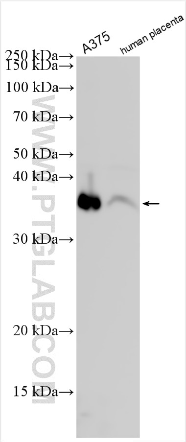 Western Blot (WB) analysis of various lysates using SPARC Polyclonal antibody (15274-1-AP)