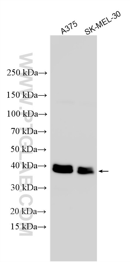 WB analysis using 33940-1-AP Western Blot (WB) analysis of various lysates using SPARC Polyclonal antibody (33940-1-AP)