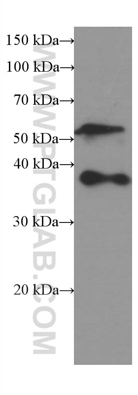 Western Blot (WB) analysis of human testis tissue using SPARC Monoclonal antibody (66426-1-Ig)