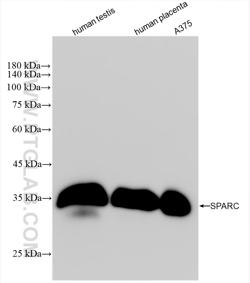 Western Blot (WB) analysis of various lysates using SPARC Recombinant antibody (84621-3-RR)
