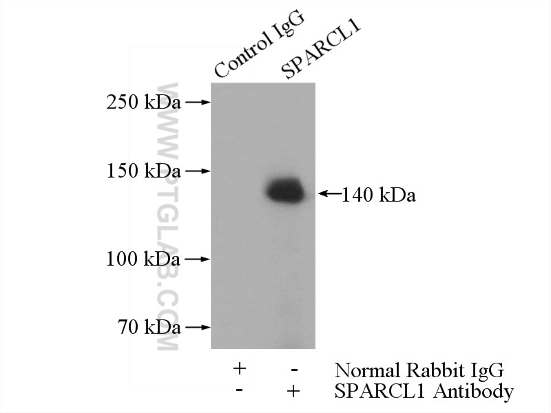 Immunoprecipitation (IP) experiment of Raji cells using SPARCL1 Polyclonal antibody (13517-1-AP)
