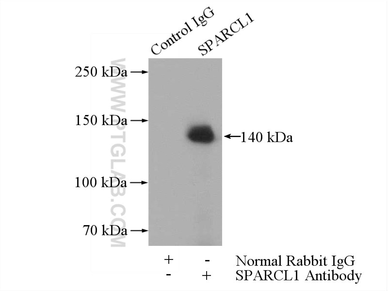 IP experiment of Raji using 13517-1-AP