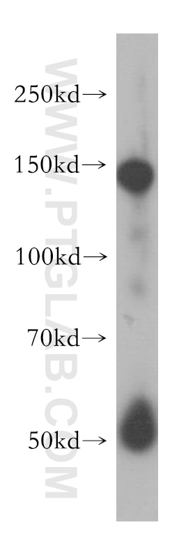 Western Blot (WB) analysis of human heart tissue using SPARCL1 Polyclonal antibody (13517-1-AP)