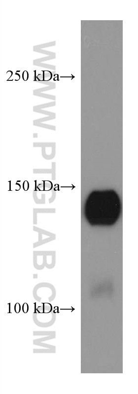 Western Blot (WB) analysis of human saliva using SPARCL1 Monoclonal antibody (67511-1-Ig)
