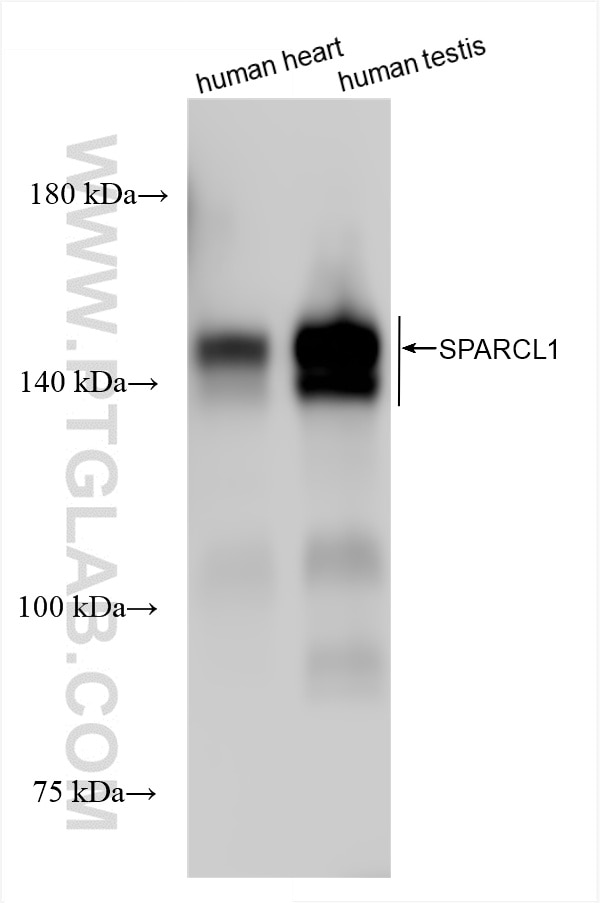 SPARCL1