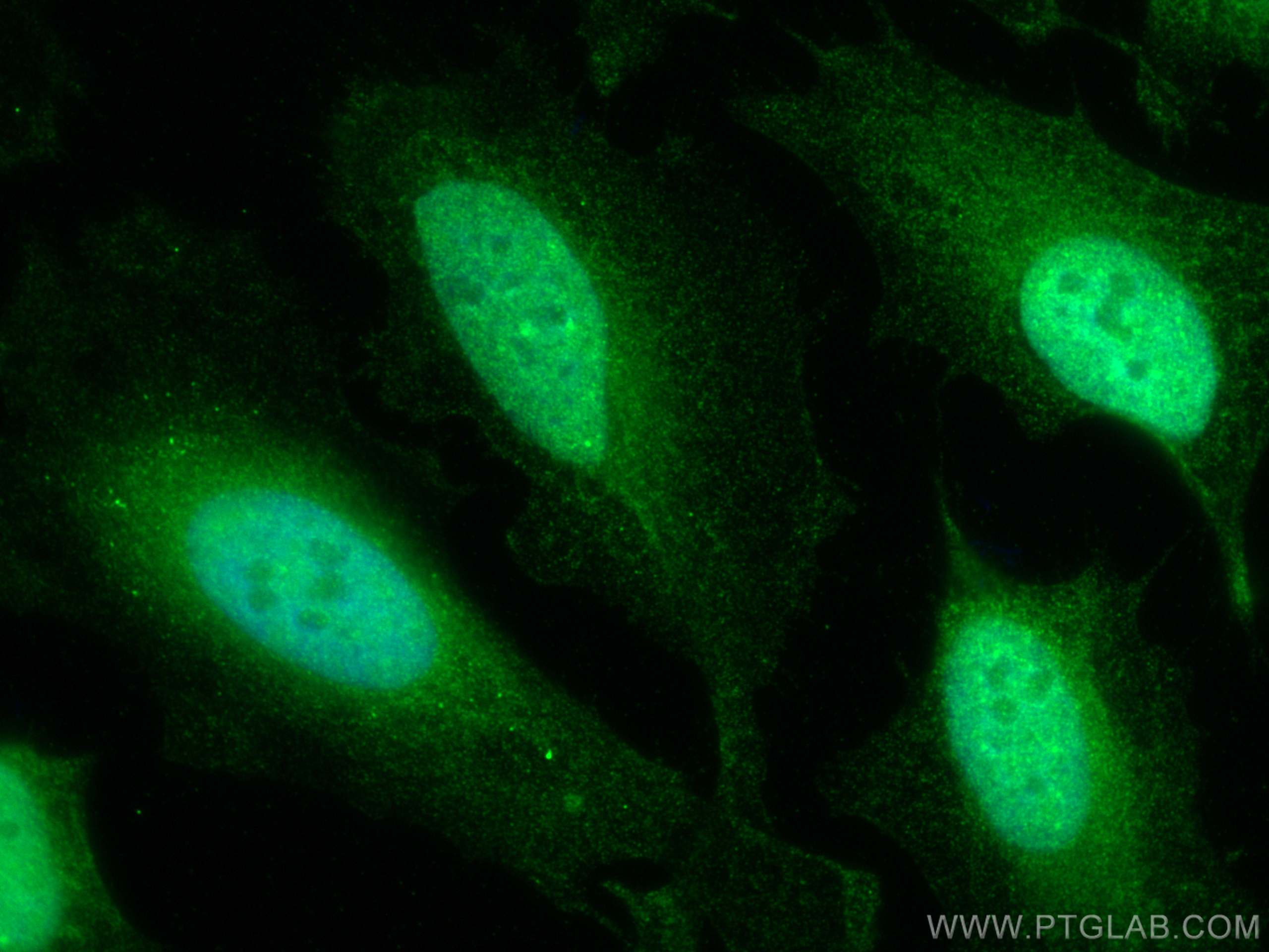 Immunofluorescence (IF) / fluorescent staining of HeLa cells using SPAST Polyclonal antibody (22792-1-AP)