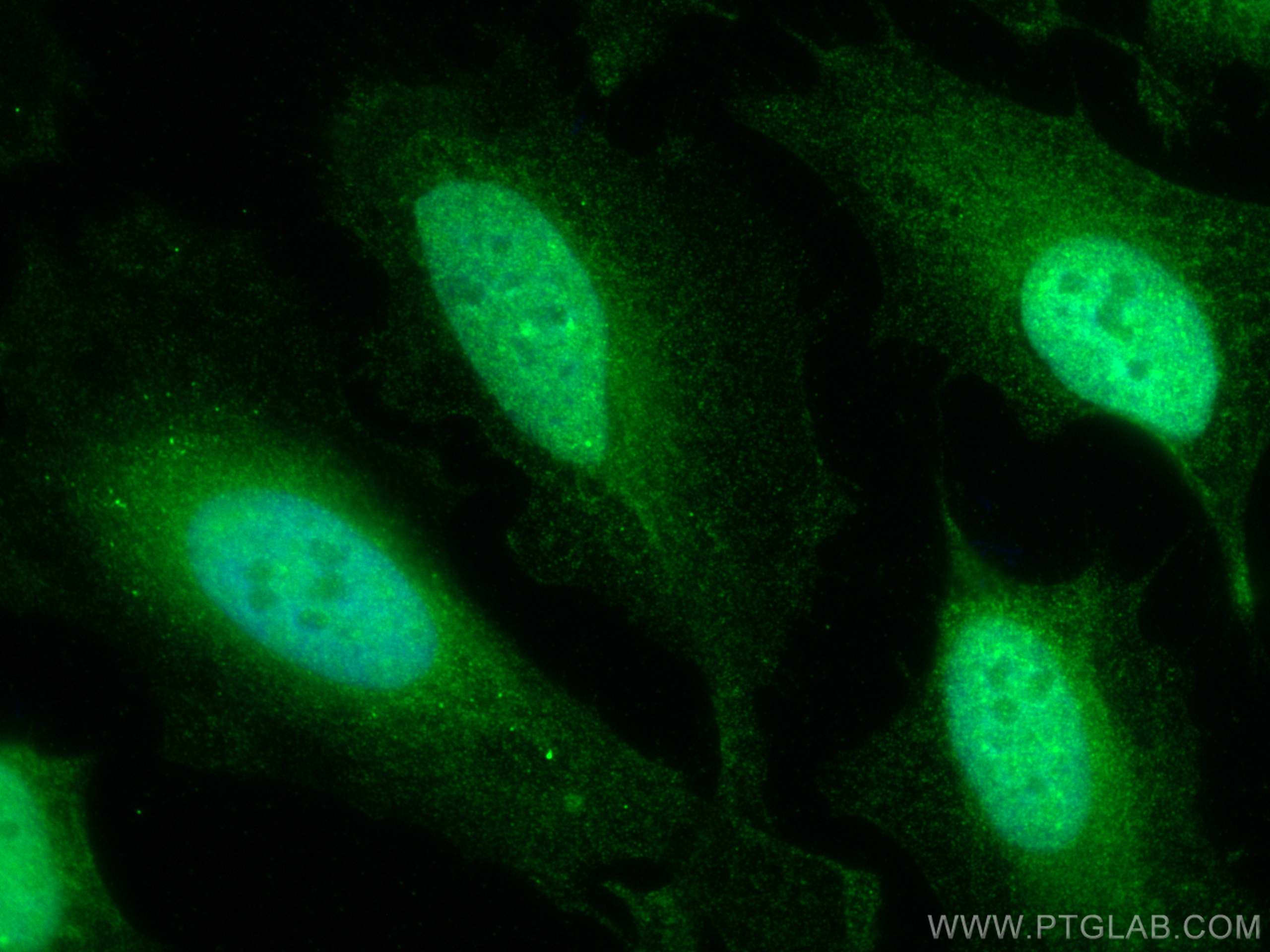 IF Staining of HeLa using 22792-1-AP