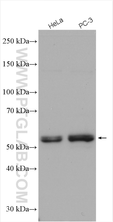 Western Blot (WB) analysis of various lysates using SPAST Polyclonal antibody (22792-1-AP)