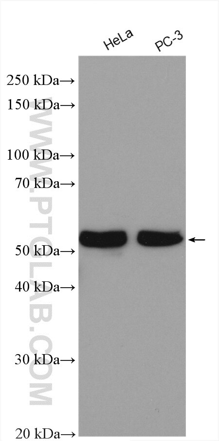Western Blot (WB) analysis of various lysates using SPAST Polyclonal antibody (22792-1-AP)
