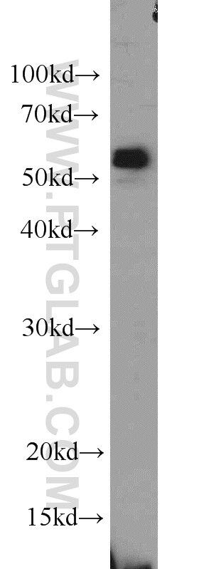 SPAST Polyclonal antibody