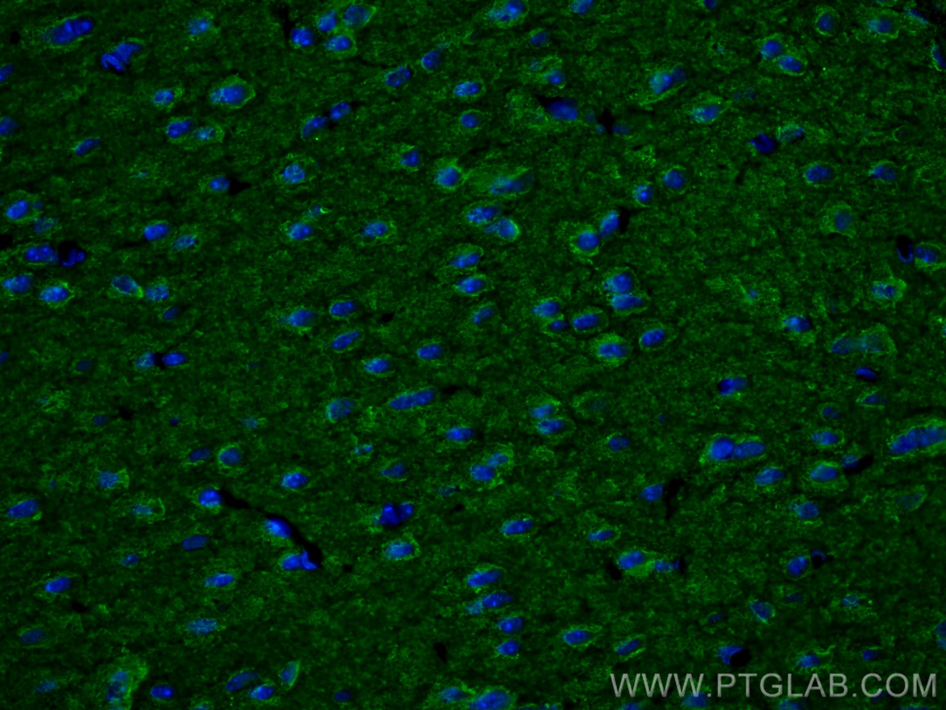 Immunofluorescence (IF) / fluorescent staining of mouse brain tissue using SPAST Monoclonal antibody (67361-1-Ig)