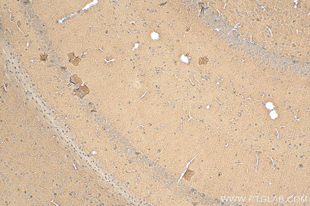 Immunohistochemistry (IHC) staining of mouse brain tissue using SPAST Monoclonal antibody (67361-1-Ig)