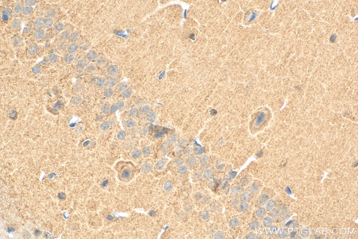Immunohistochemistry (IHC) staining of mouse brain tissue using SPAST Monoclonal antibody (67361-1-Ig)