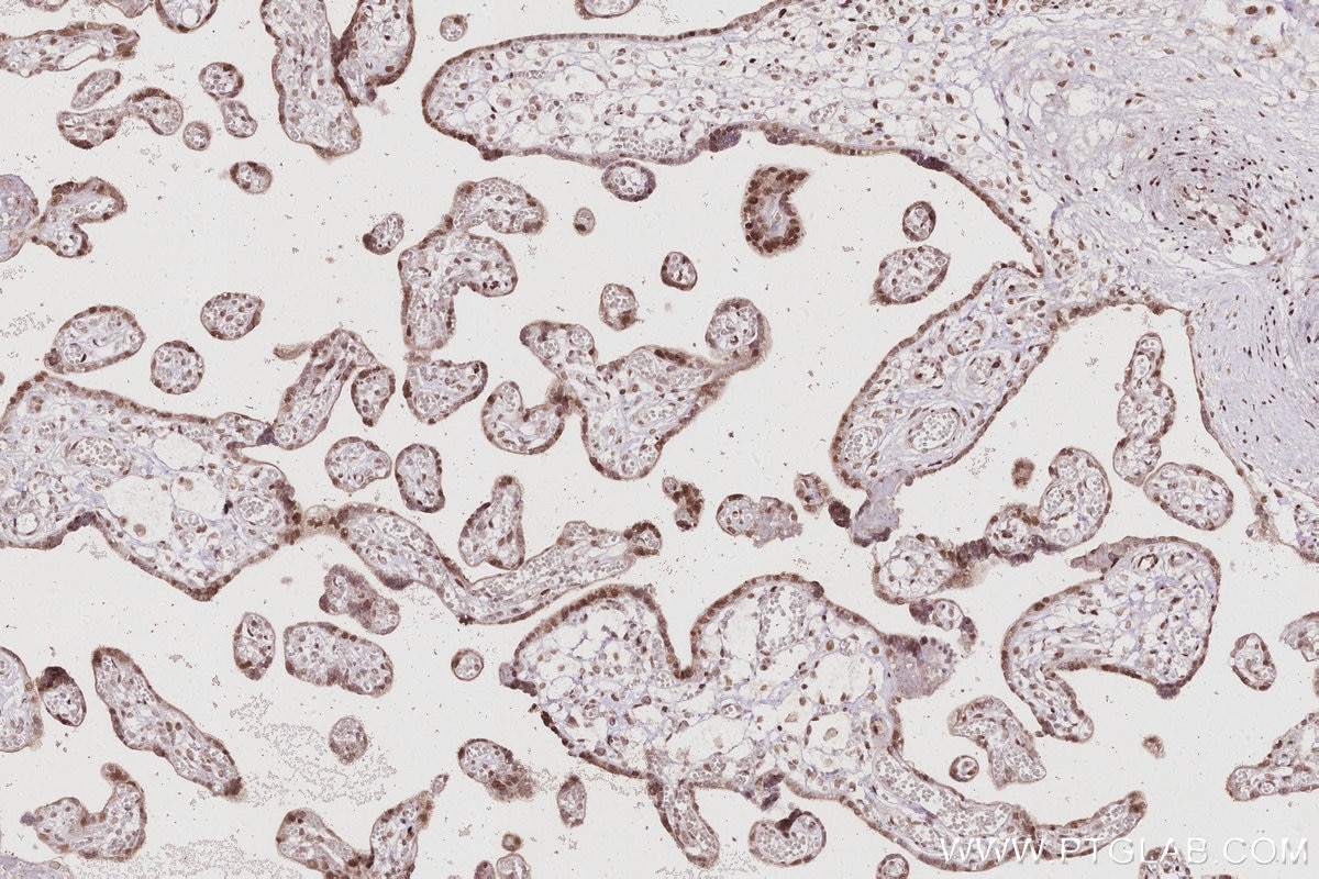IHC staining of human placenta using 67361-1-Ig Immunohistochemistry (IHC) staining of human placenta tissue using SPAST Monoclonal antibody (67361-1-Ig)