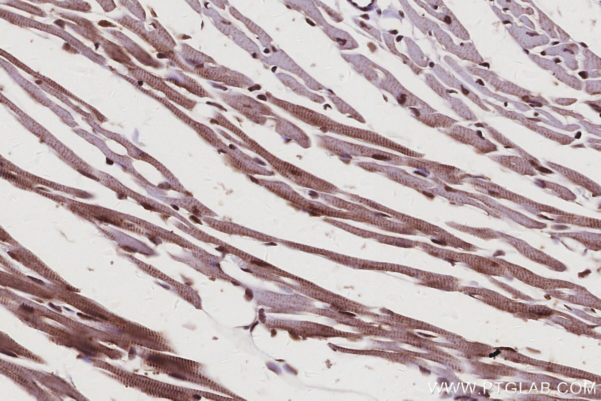 IHC staining of mouse heart using 67361-1-Ig Immunohistochemistry (IHC) staining of mouse heart tissue using SPAST Monoclonal antibody (67361-1-Ig)