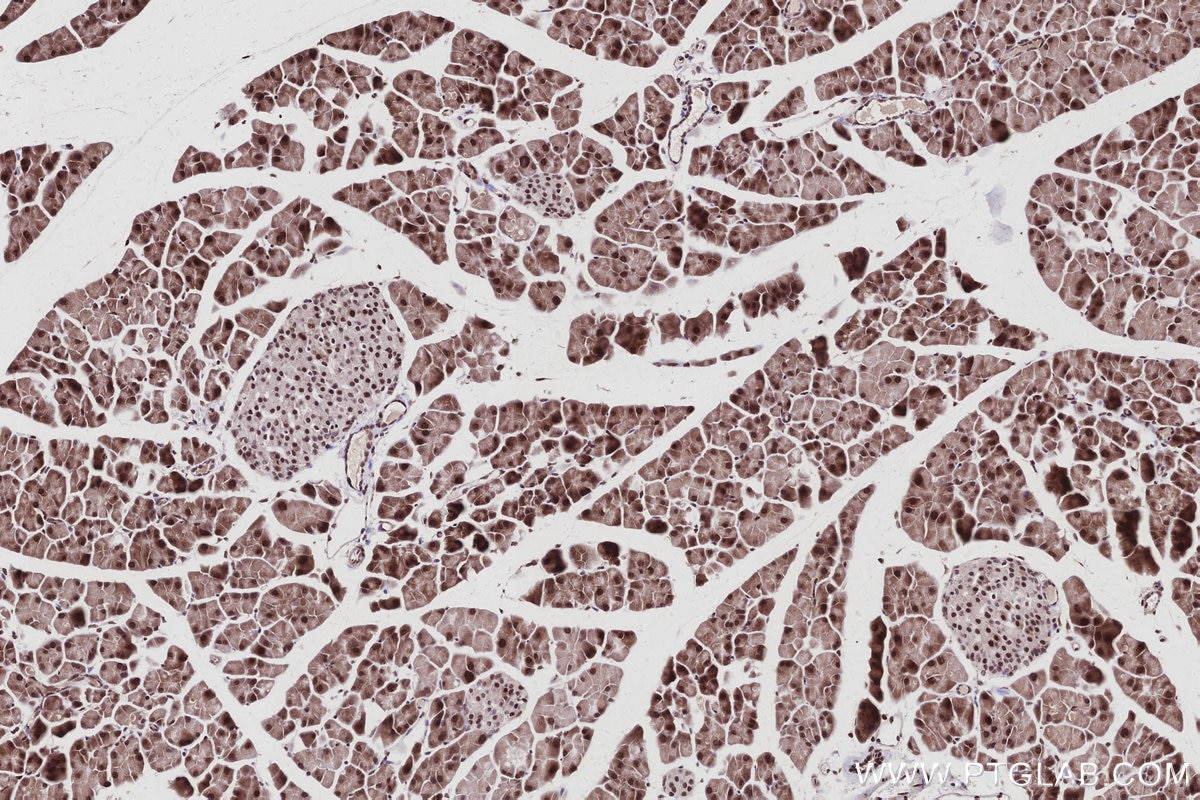 IHC staining of mouse pancreas using 67361-1-Ig Immunohistochemistry (IHC) staining of mouse pancreas tissue using SPAST Monoclonal antibody (67361-1-Ig)