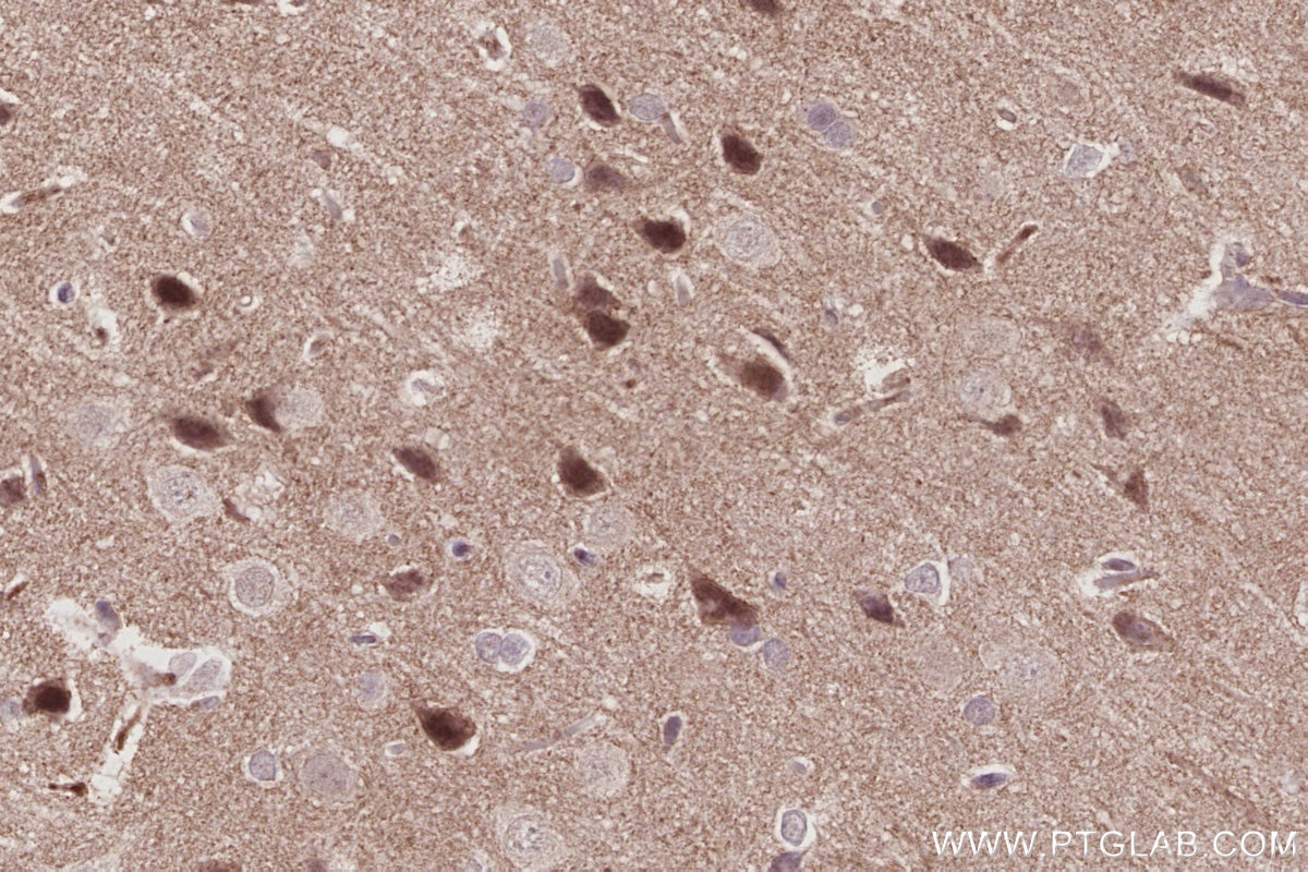 IHC staining of rat brain using 67361-1-Ig Immunohistochemistry (IHC) staining of rat brain tissue using SPAST Monoclonal antibody (67361-1-Ig)