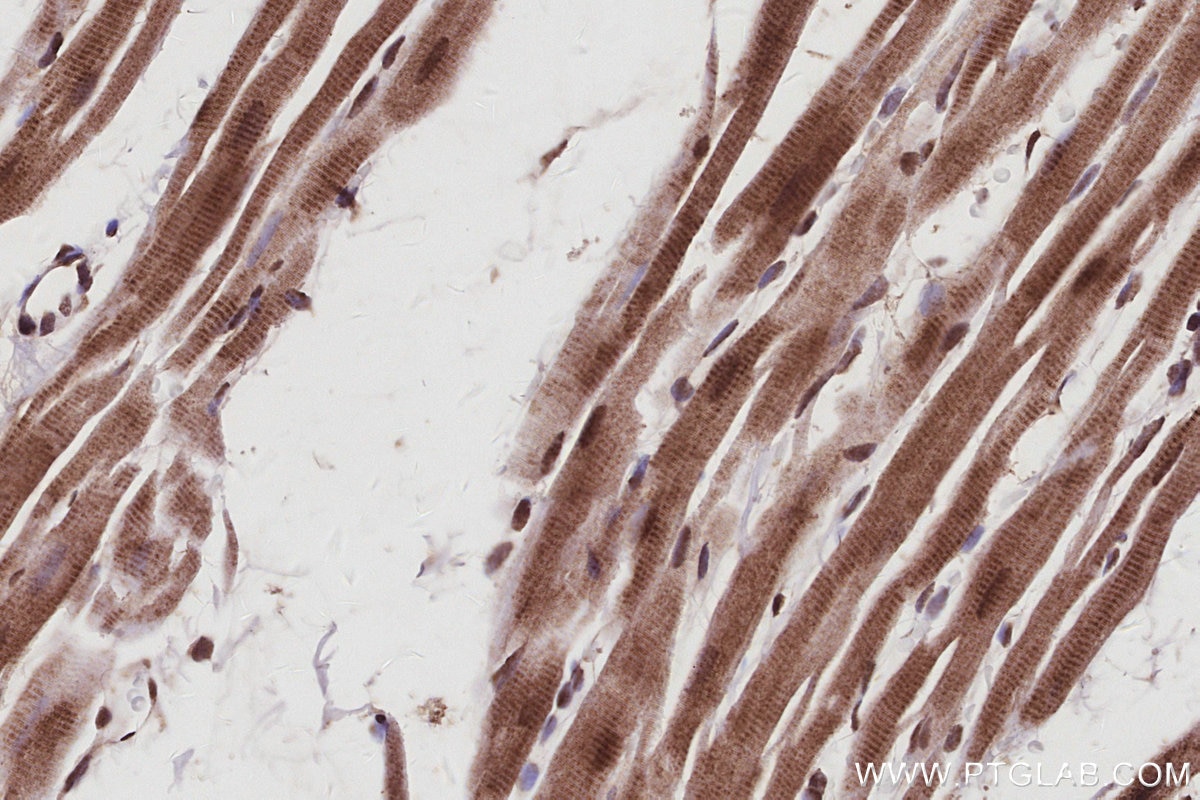 IHC staining of rat heart using 67361-1-Ig Immunohistochemistry (IHC) staining of rat heart tissue using SPAST Monoclonal antibody (67361-1-Ig)