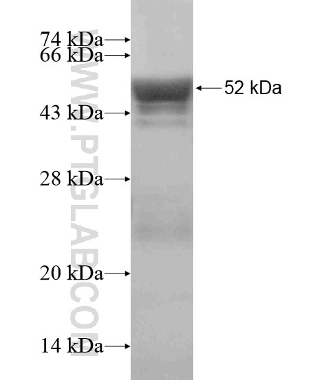 SPAST fusion protein Ag18797 SDS-PAGE