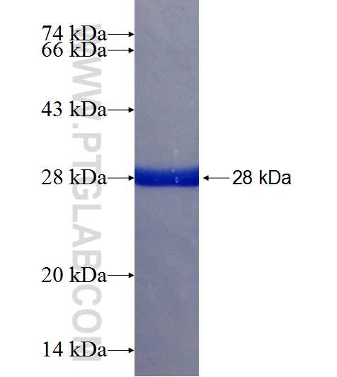 SPAST fusion protein Ag18866 SDS-PAGE