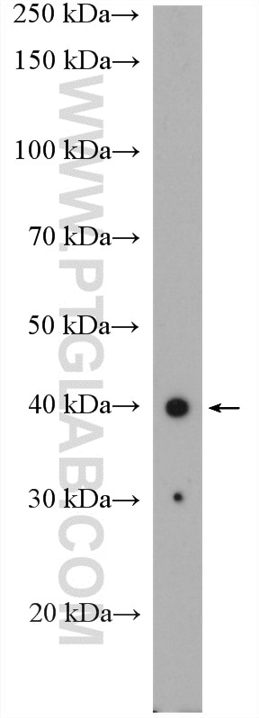 WB analysis of HeLa using 24980-1-AP