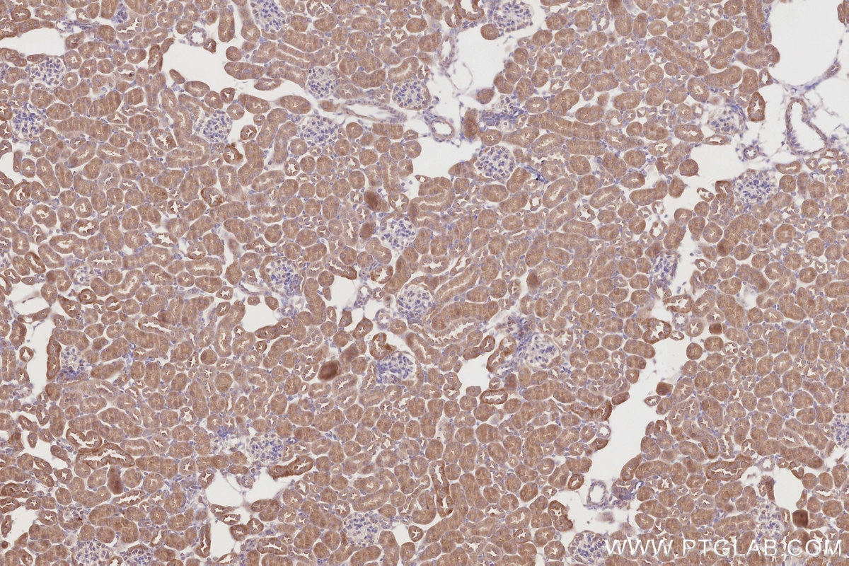 Immunohistochemistry (IHC) staining of mouse kidney tissue using SPATA13 Polyclonal antibody (21400-1-AP)