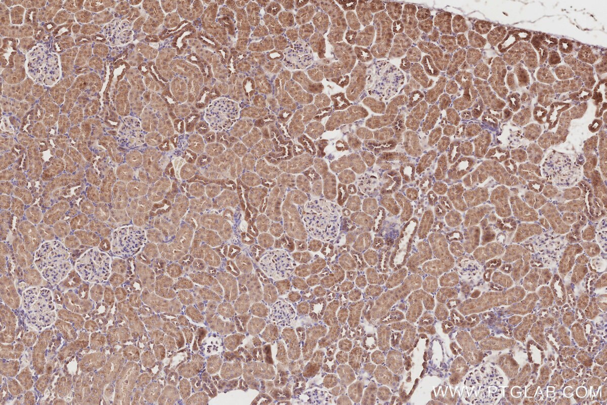 Immunohistochemistry (IHC) staining of rat kidney tissue using SPATA13 Polyclonal antibody (21400-1-AP)