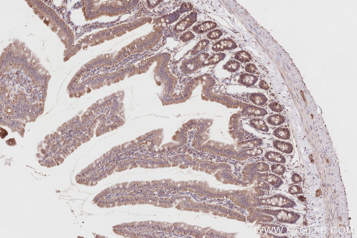 Immunohistochemistry (IHC) staining of rat small intestine tissue using SPATA13 Polyclonal antibody (21400-1-AP)