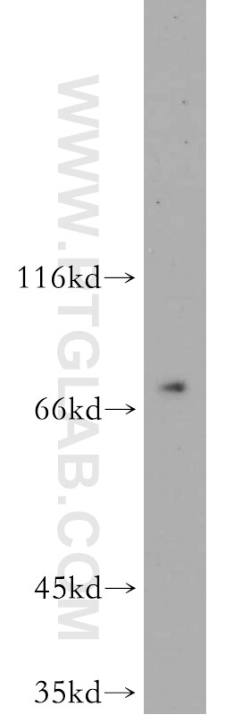 Western Blot (WB) analysis of human placenta tissue using SPATA13 Polyclonal antibody (21400-1-AP)