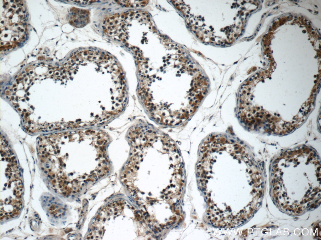 Immunohistochemistry (IHC) staining of human testis tissue using SPATA16 Polyclonal antibody (17357-1-AP)