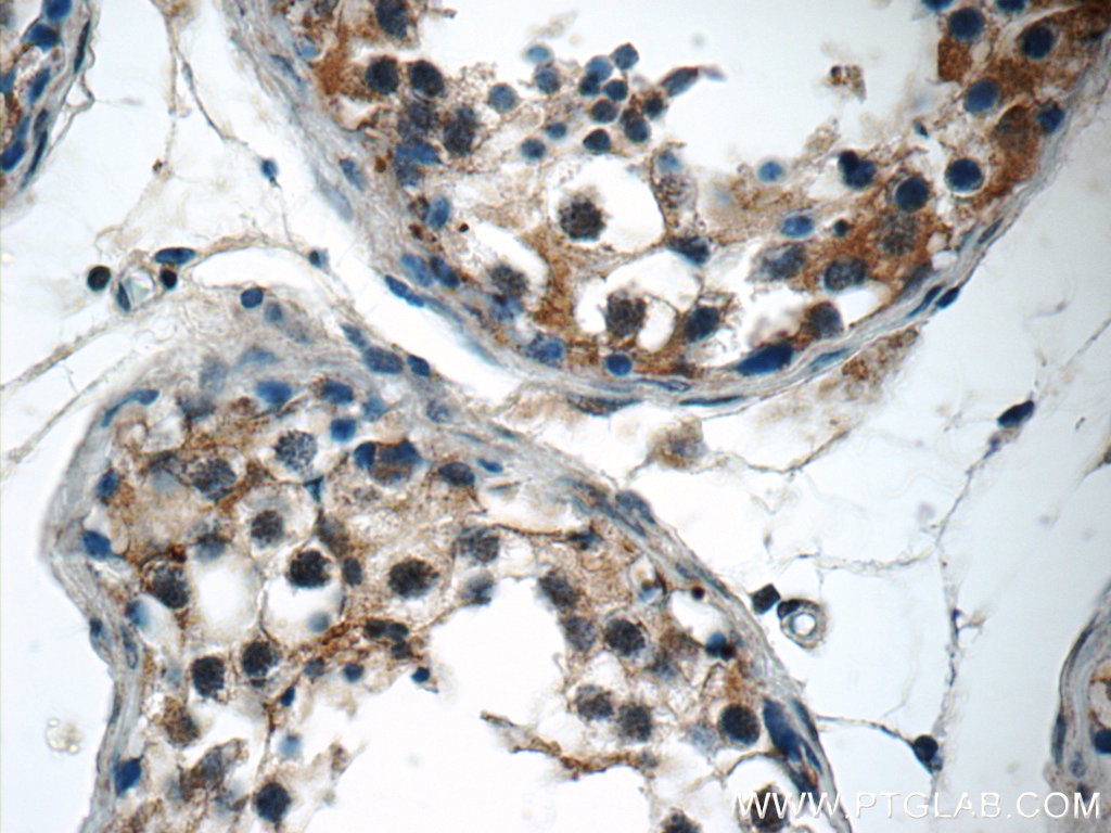 Immunohistochemistry (IHC) staining of human testis tissue using SPATA16 Polyclonal antibody (17357-1-AP)