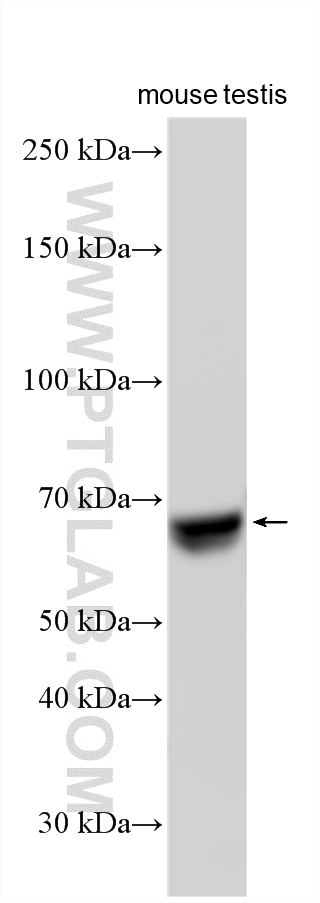 Mouse testis tissue lysate was subjected to SDS PAGE followed by western blot with 31808-1-AP (SPATA18 antibody) at dilution of 1:3000 incubated at room temperature for 1.5 hours. Western Blot (WB) analysis of various lysates using SPATA18 Polyclonal antibody (31808-1-AP)
