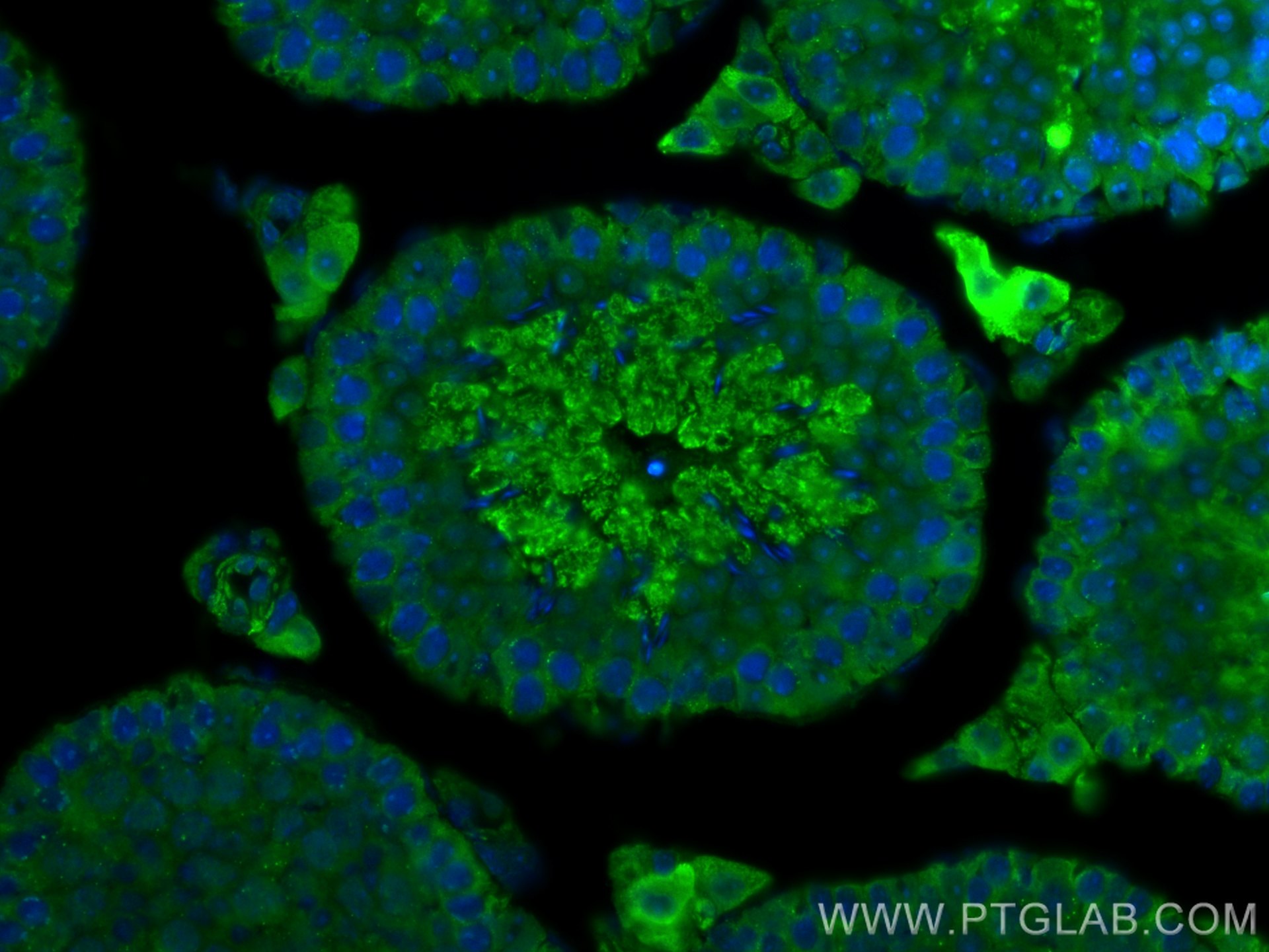 Immunofluorescence (IF) / fluorescent staining of mouse testis tissue using SPATA19 Polyclonal antibody (16656-1-AP)