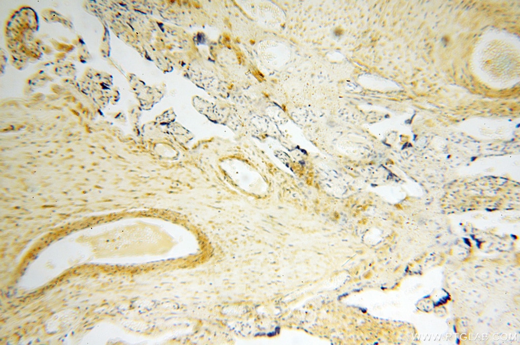 Immunohistochemistry (IHC) staining of human placenta tissue using SPATA19 Polyclonal antibody (16656-1-AP)