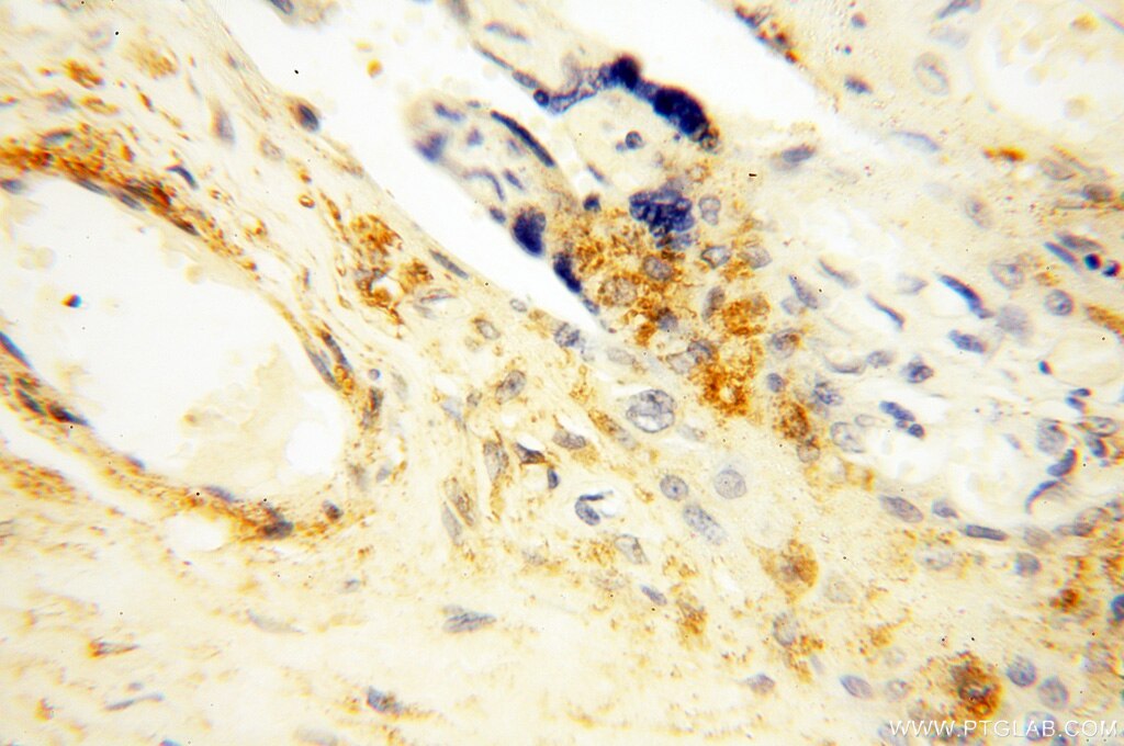 Immunohistochemistry (IHC) staining of human placenta tissue using SPATA19 Polyclonal antibody (16656-1-AP)