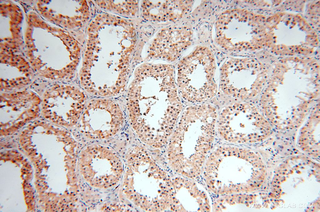 Immunohistochemistry (IHC) staining of human testis tissue using SPATA19 Polyclonal antibody (16656-1-AP)
