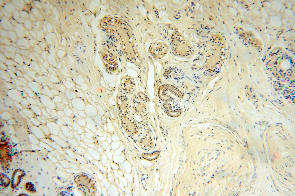 Immunohistochemistry (IHC) staining of human skin tissue using SPATA19 Polyclonal antibody (16656-1-AP)